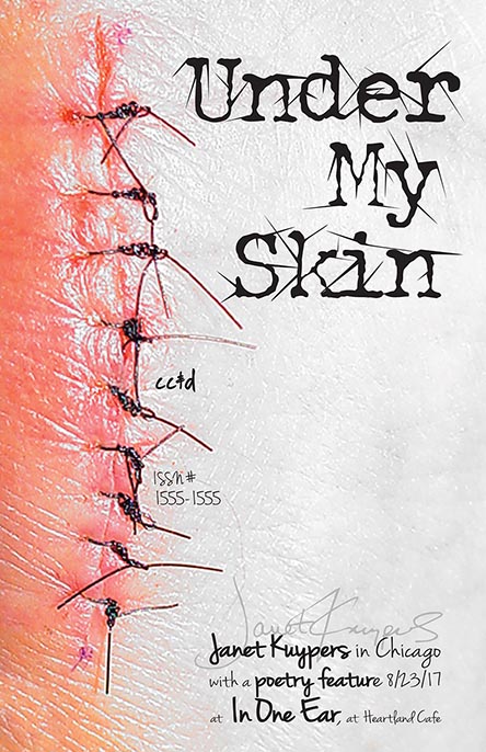 Under My Skin